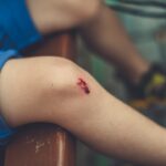 Photo itchy elbow