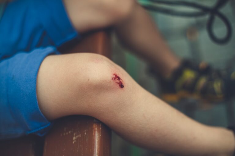 Photo itchy elbow